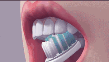 姑娘坚持早晚刷牙5分钟，结果却发现自己刷坏了二十多颗牙……