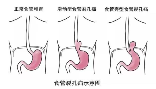 屏幕快照 2023-03-13 下午6.33.50.png