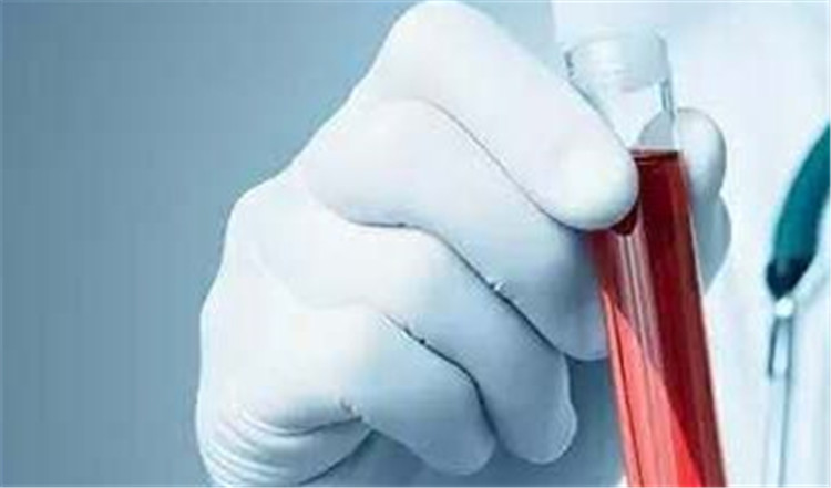 体外检测.jpg 体外检测.jpg