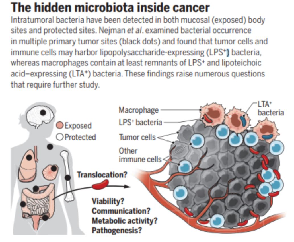 双侧腮腺同时发生不同病理类型的良性肿瘤 1 例