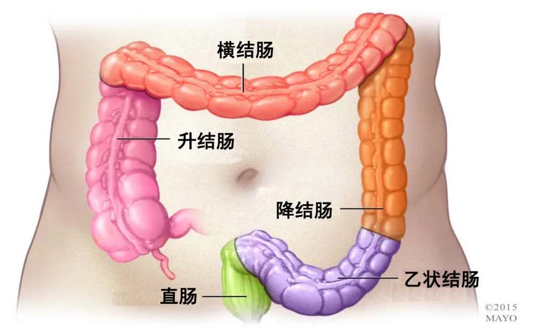 这类患者,往往整个结肠的蠕动功能都有异常,医生会为患者行全结肠切除