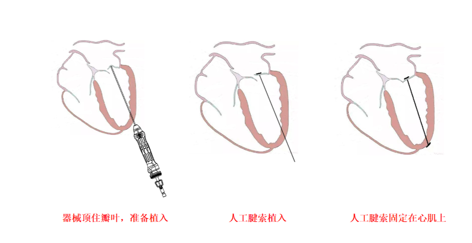 屏幕快照 2021-05-30 下午8.32.00.png 屏幕快照 2021-05-30 下午8.32.00.png