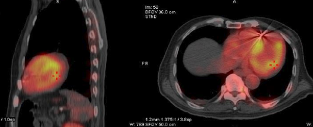 内 716195054_副本.png 内 716195054_副本.png